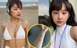 Hot girl người Tày Ceri Thu Hà lần đầu nói về các vết thương chằng chịt trên cánh tay