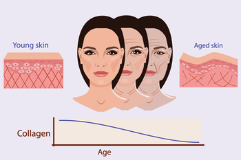 Vì sao nếp nhăn lại xuất hiện khi ta già đi? - Ảnh 2.