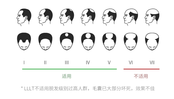 Xiaomi ra mắt mũ kích thích mọc tóc cho người bị hói, giá 4.9 triệu đồng - Ảnh 3.