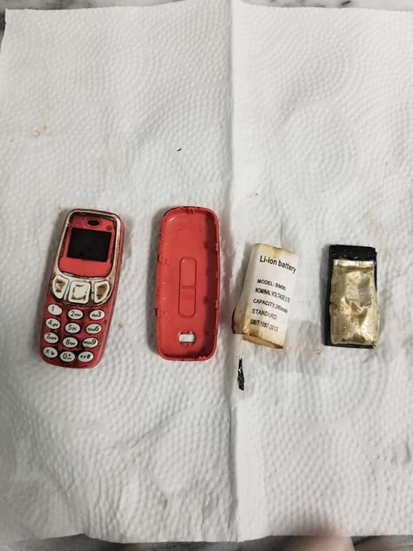 Nuốt nguyên chiếc điện thoại Nokia, nam game thủ đau bụng dữ dội, tới viện khẩn cầu bác sĩ và cái kết - Ảnh 3.