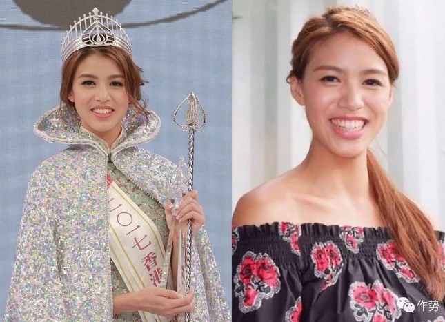 Nhan sắc xấu nhất của Hoa hậu Hong Kong sau 5 năm bị chê - Ảnh 1.
