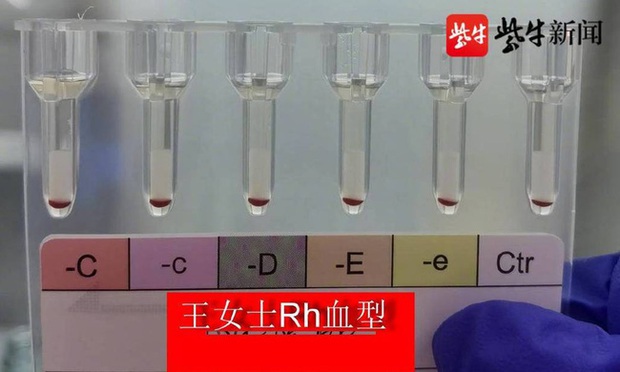  Phát hiện 2 người có nhóm máu vàng hiếm nhất trên thế giới tại Trung Quốc - Ảnh 1.