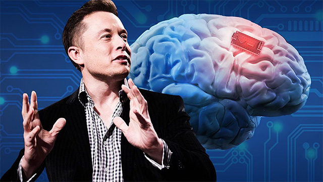 Elon Musk tự tin về công nghệ cấy chip não - Ảnh 1.