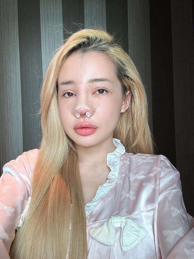 Ngân 98 và những cú lộ mặt mộc gây sốc tâm lý- Ảnh 11.