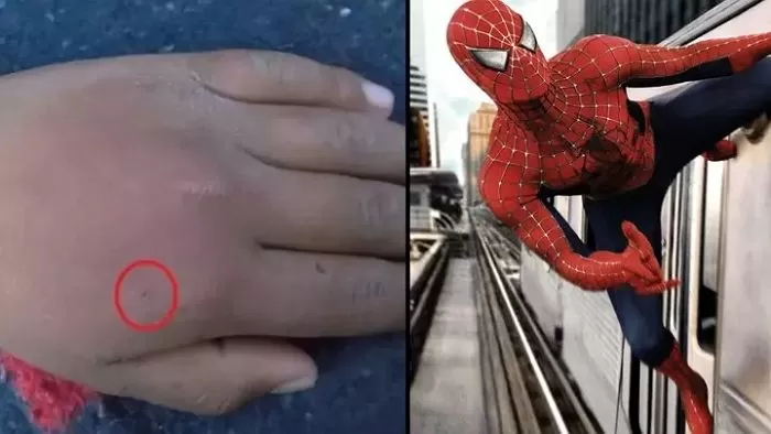 Cho nhện cắn với mong ước trở thành Spider-Man, nam game thủ nhập viện khẩn cấp- Ảnh 1.