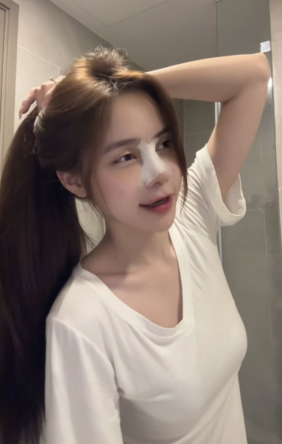 Hậu phẫu thuật thẩm mỹ, 