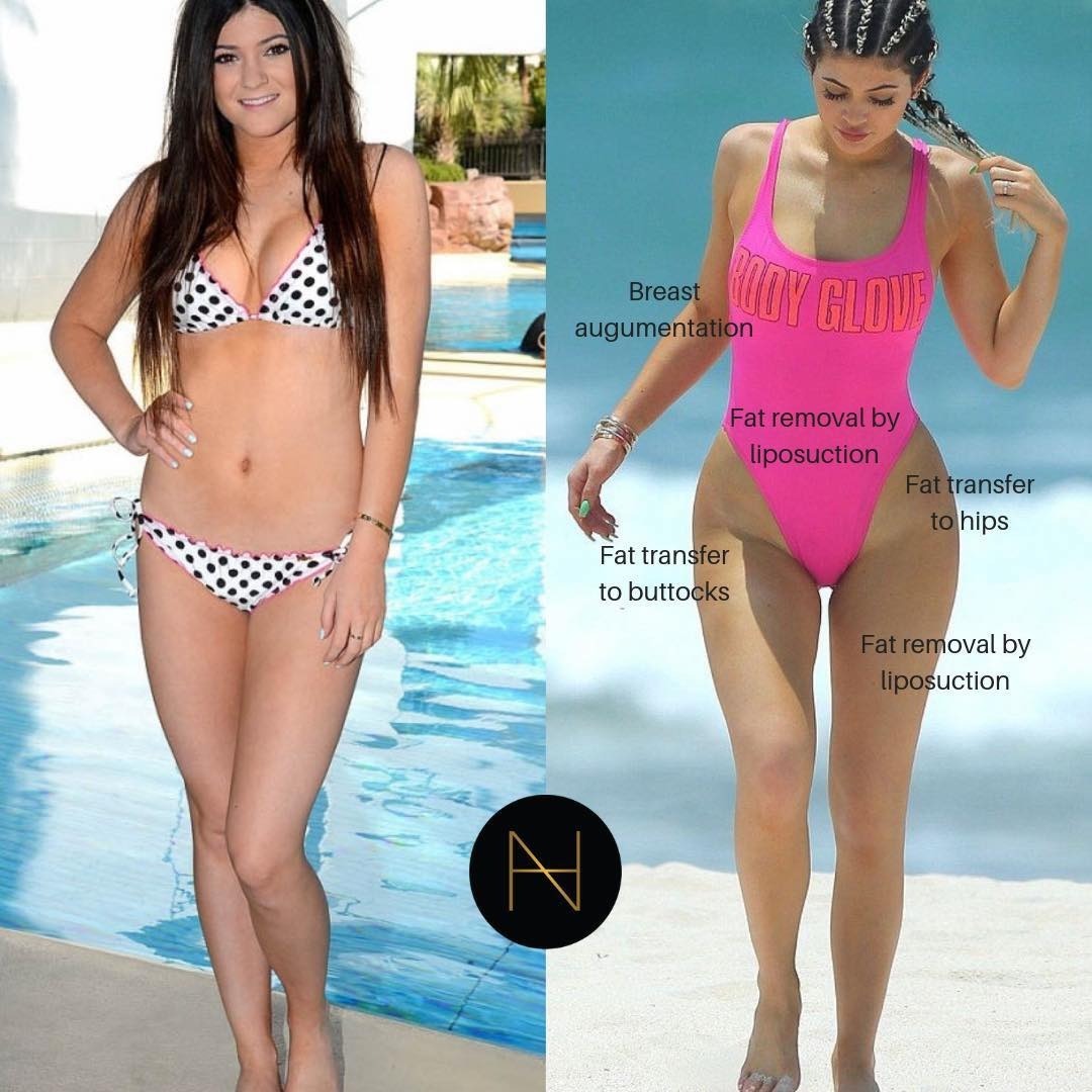 Kylie Jenner hóa búp bê Barbie với bikini bé xíu, khoe body "nóng" đến mức khán giả phát ngại- Ảnh 7.