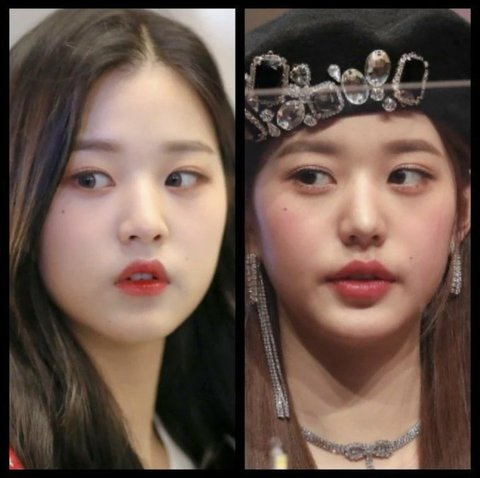 Từ "búp bê sống" đến nghi vấn thẩm mỹ quá đà, nàng It Girl đình đám đang tự hủy nhan sắc vì filler- Ảnh 4.