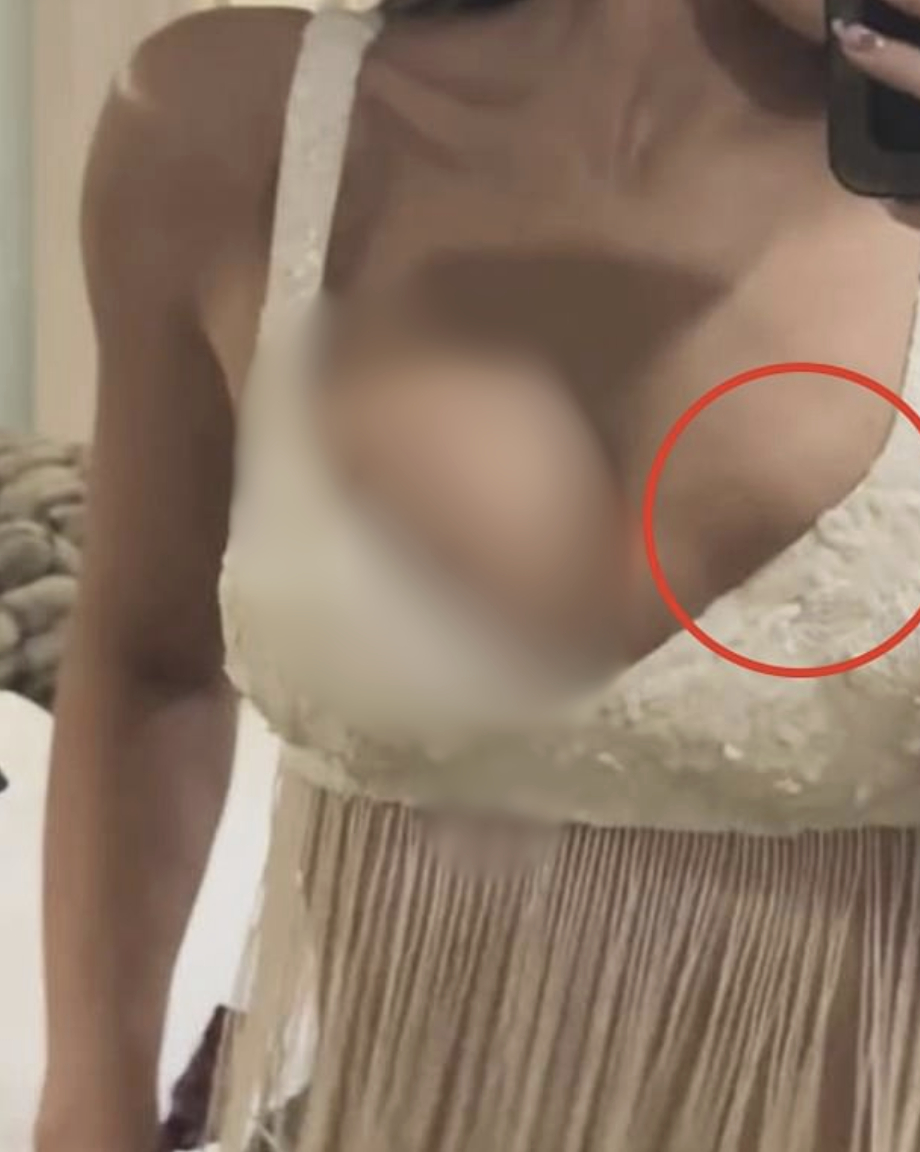 Dân tình nghi Kylie Jenner bị vỡ túi ngực khi bung xoã cực vui ở Coachella- Ảnh 6.