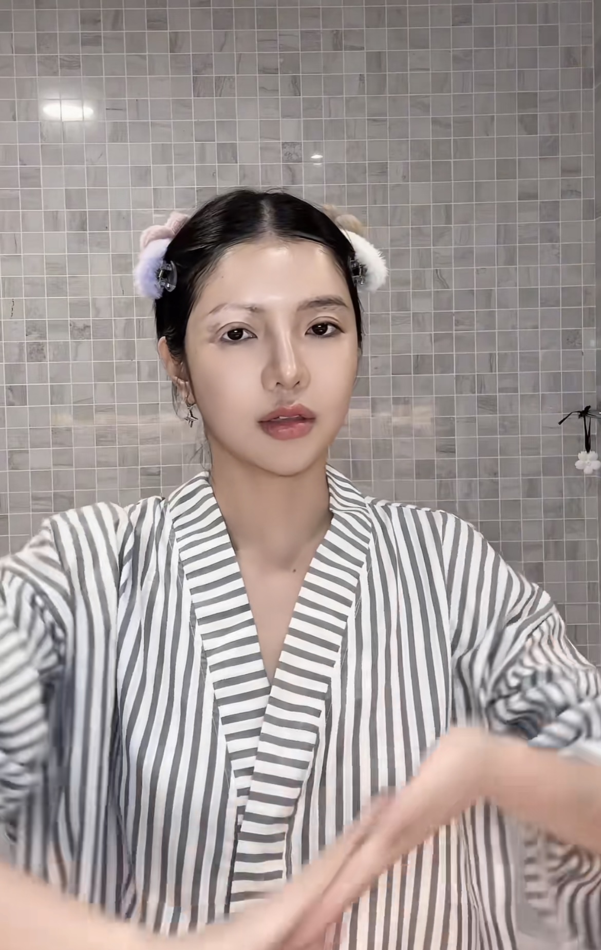 Mỹ nhân Việt mắc bệnh hiếm chỉ 2% dân số thế giới gặp phải- Ảnh 1.