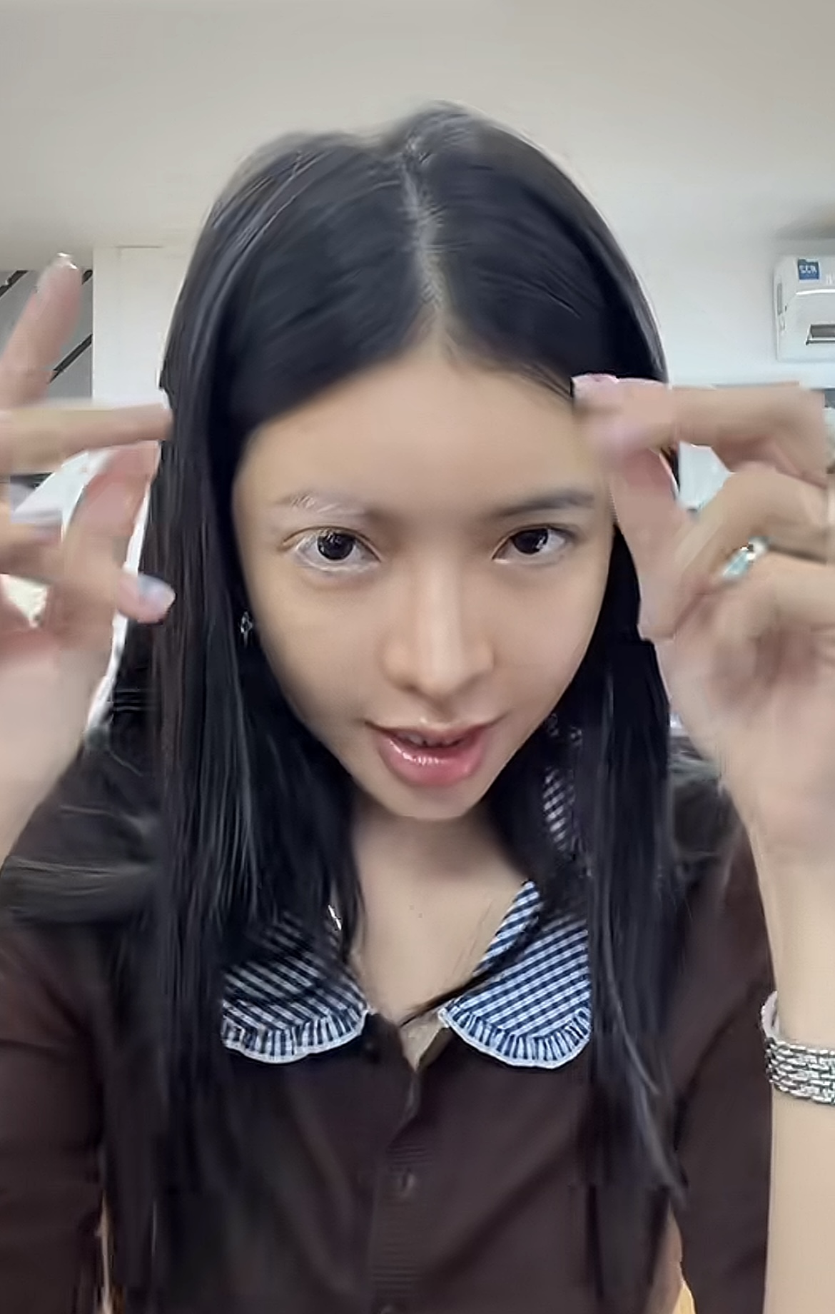 Mỹ nhân Việt mắc bệnh hiếm chỉ 2% dân số thế giới gặp phải- Ảnh 2.