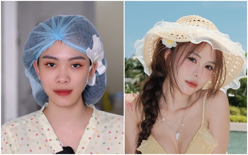 Hà Môi “đắp tiền lên mặt” để sửa những gì? Còn chiếc mũi “đang hếch dần và méo” giờ ra sao?- Ảnh 1.