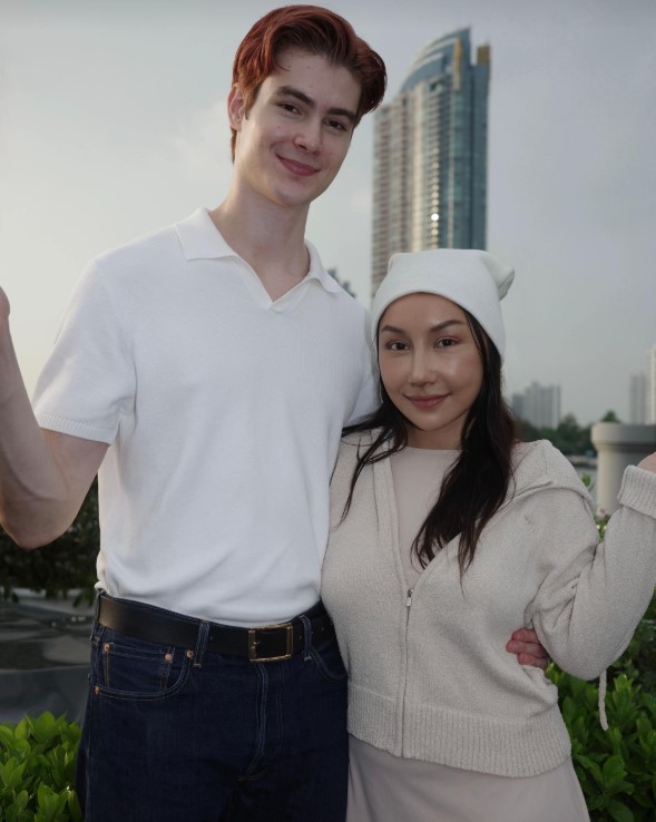 Gương mặt sau 21 ngày phẫu thuật thẩm mỹ của cô vợ cao 1m55 áp lực vì chồng Tây quá đẹp trai, cao gần 2m- Ảnh 10.