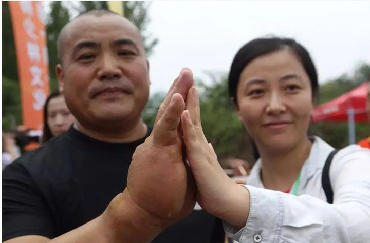 Võ sư Trung Quốc luyện thần công Kim Dung suốt 20 năm, bàn tay dày 8cm- Ảnh 4. Võ sư Trung Quốc luyện thần công Kim Dung suốt 20 năm, bàn tay dày 8cm- Ảnh 4.