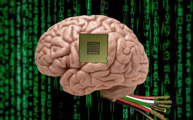 Cấy chip AI vào não có thể khiến bạn mất trí - Ảnh 1.