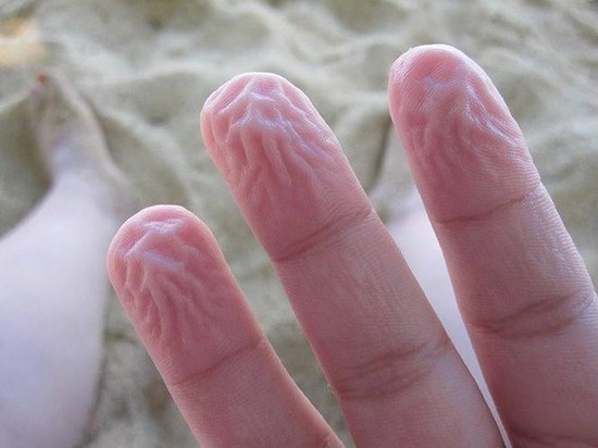 Vì sao mà da tay bạn nhăn nheo sau mỗi lần rửa bát? - Ảnh 2.