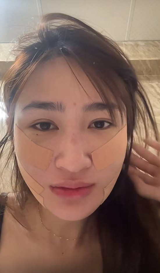 Mỹ nhân SN 2001 đóng phim giờ vàng VTV công khai dung mạo sau khi hút mỡ mặt- Ảnh 3.
