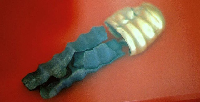 Những vật liệu kỳ dị nhất từng được con người sử dụng làm bao cao su Gold-condom-1602599446041617632116