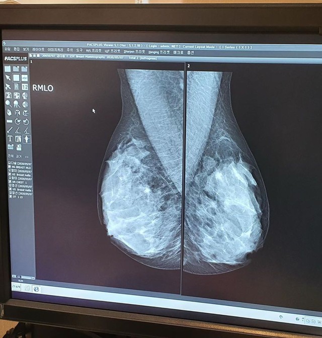 cô nàng hot girl quyết tâm đi chụp X-quang, chứng minh ngực của mình tự nhiên 100% Photo-2-1603374007787683830616