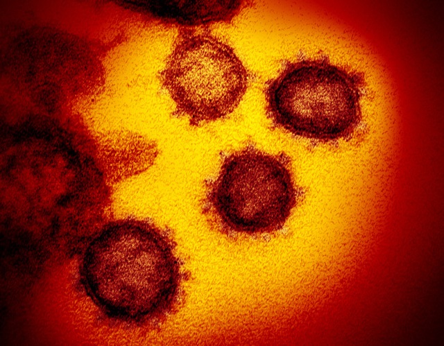 Chụp được ảnh virus Covid-19 ở độ phân giải nguyên tử, các nhà khoa học khám phá ra bản chất lây nhiễm hóa học của nó - Ảnh 1.