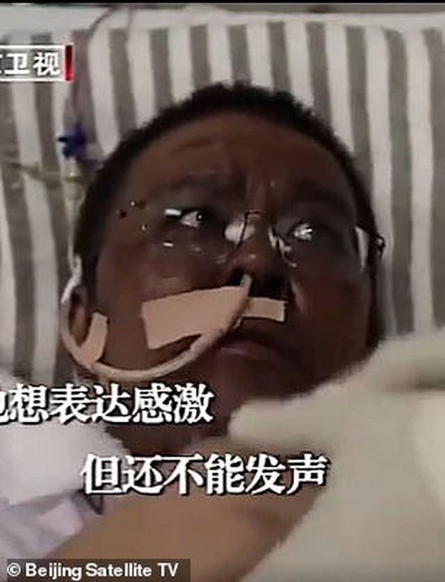 Hai bác sĩ Trung Quốc có làn da bị đổi sang màu nâu sau một thời gian dài chống chọi với Covid-19 - Ảnh 4.