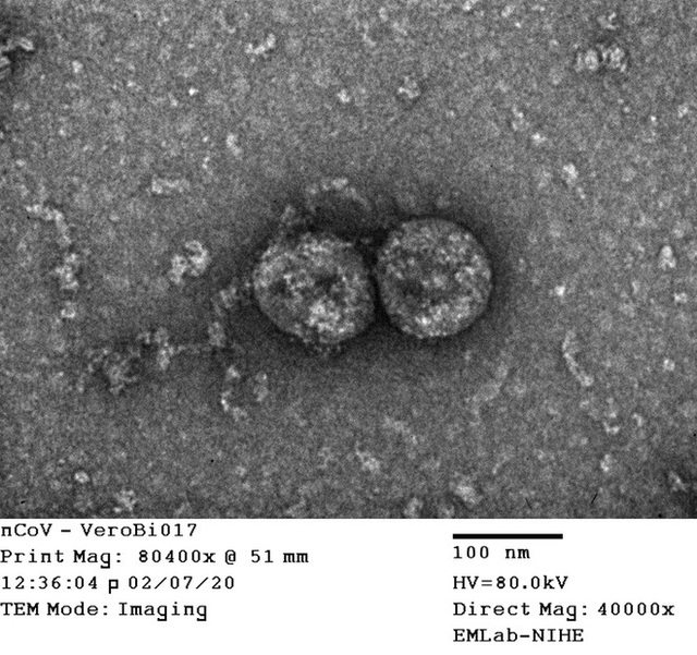 Virus gây dịch COVID-19 tại Việt Nam đã biến đổi thành 2 nhóm khác hẳn nhau - Ảnh 1.