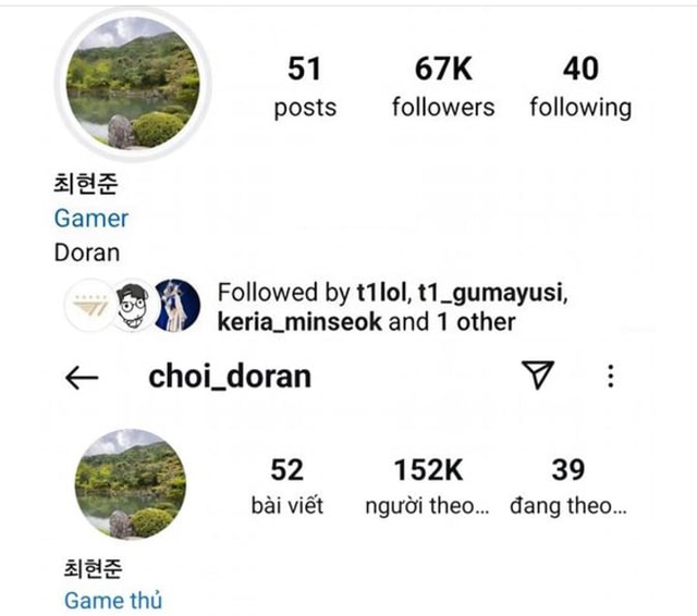 Số follow IG của Doran tăng vọt khủng khiếp