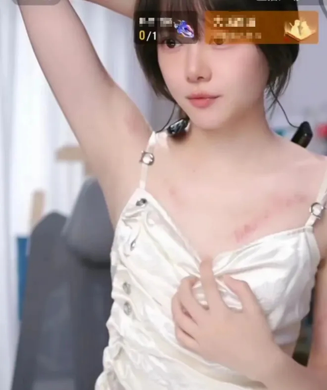 Nữ thần LPL bất ngờ xuất hiện với nhiều vết bầm tím, nghi vấn bị bạo hành khiến người xem hốt hoảng- Ảnh 2. Nữ thần LPL bất ngờ xuất hiện với nhiều vết bầm tím, nghi vấn bị bạo hành khiến người xem hốt hoảng- Ảnh 2.