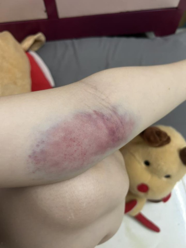 Nỗi niềm khó nói của hội chị em khi chơi bắn cung, nhìn "hậu quả" khiến ai cũng phải xót xa- Ảnh 6.