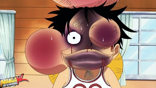  Luffy bầm dập sau trận đòn của Nami 