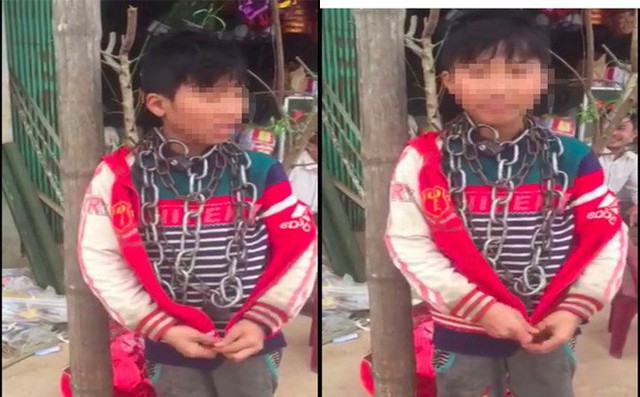 Hình ảnh bé trai bị xích cổ được đăng tải trên mạng xã hội. (Ảnh: Cắt từ clip)