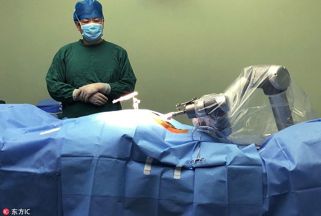 Robot Trung Quốc thực hiện ca phẫu thuật thành công trên cơ thể người, mở ra một tương lai mới cho toàn thế giới - Ảnh 1.