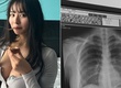 Hot girl Nhật công khai ảnh chụp X-quang, hút 43 triệu lượt xem
