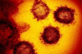SCMP: Phát hiện SARS-COV-2 có đột biến gen giống HIV và Ebola, hứa hẹn tìm ra cách chữa trị hiệu quả