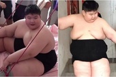 14 tuổi nặng 180kg, cậu nhóc ăn gấp 7 lần người bình thường, phụ huynh phải lên YouTube cầu viện "cứu trợ"