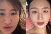 Mỹ nhân SN 2001 đóng phim giờ vàng VTV công khai dung mạo sau khi hút mỡ mặt