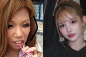 Cô gái làm bảo vệ, đốt cả gia tài cho 27 ca phẫu thuật để trở thành mỹ nhân