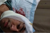 Liên Minh Huyền Thoại: Siêu Sao Xạ Thủ Bắc Mĩ - Hi Im Gosu gặp tai nạn xe hơi nghiêm trọng