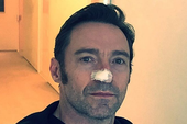 Wolverine - Hugh Jackman bị ung thư da, chụp ảnh sau phẫu thuật cho fan hâm mộ