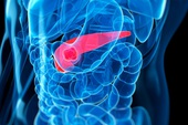 Israel tìm ra cách diệt tế bào ung thư tuyến tụy chỉ trong 14 ngày