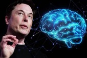 Elon Musk giới thiệu công nghệ hợp nhất não người với AI, phải chăng thời đại Detroit: Become Human sắp đến?