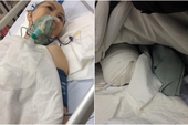Hà Nội: Con gái rủ cậu ruột vào bệnh viện cắt đứt lìa chân mẹ