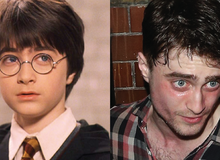 Daniel Radcliffe đổ lỗi vì Harry Potter quá hot biến anh thành kẻ nghiện rượu, đóng bao nhiêu phim cũng mãi vô danh