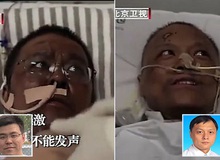 Hai bác sĩ Trung Quốc có làn da bị đổi sang màu nâu sau một thời gian dài chống chọi với Covid-19