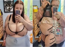 Sở hữu vòng một quá khổ nặng tới 25kg, cô gái đăng đàn kể khổ với CĐM, bức xúc khi bị bệnh viện từ chối giảm cân