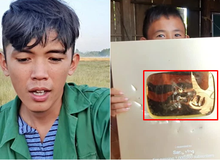 YouTuber "nghèo" nhất Việt Nam bất ngờ gặp hạn, bị trộm hỏi thăm ngay đầu năm, nút Vàng nút Bạc YouTube bị "cạy" sạch
