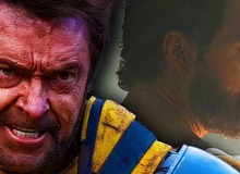 “Người Sói” Hugh Jackman hé lộ cái tên phù hợp nhất cho vai trò Wolverine kế nhiệm