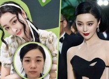 37 ca phẫu thuật, gần 30 tỷ đồng và cái kết cay đắng của người phụ nữ muốn trở thành Phạm Băng Băng thứ hai