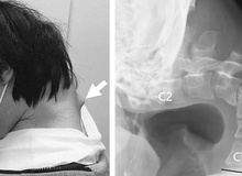 Những hình ảnh đáng sợ của việc chơi game không khoa học, cảnh báo cho game thủ