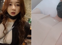 Bị nghi ngờ dao kéo, nữ streamer thẳng thừng tới bệnh viện, livestream công khai chứng minh